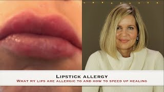 Lipstick Allergy  What I am allergic to and how to speed up healing [upl. by Erfert959]