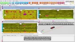 CIVA UT Analysis  Segmentation in one click [upl. by Auqenaj]