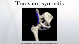 Transient synovitis [upl. by Ainirtac58]