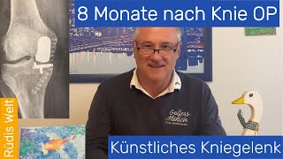 8 Monate nach KnieOP  Künstliches Kniegelenk nach Arthrose  Oxfordschlitten [upl. by Nalyac521]