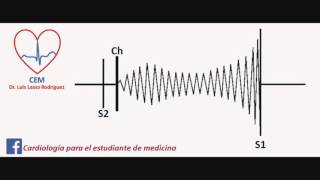 Soplo de la estenosis mitral [upl. by Neraa]