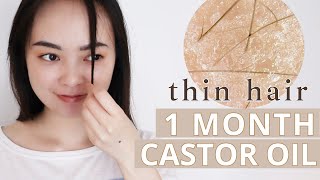 30 Days of Castor Oil on My Thin Hair [upl. by Cassius]