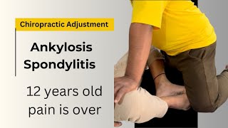 Ankylosing Spondylitis  Symptoms and Treatment Rheumatologist [upl. by Ahsinned]