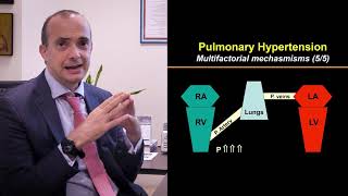Lipertensione polmonare  prof Francesco Grigioni UCBM per Fattore J [upl. by Ingamar]