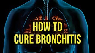 How To Cure Bronchitis Fast  5 Quick Ways [upl. by Anaujnas829]