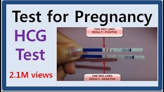 TEST FOR PREGNANCY [upl. by Carline]