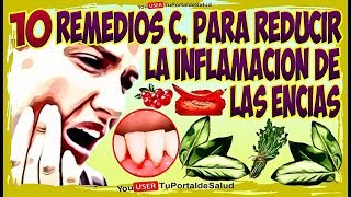 10 Remedios Caseros Para Reducir Inflamacion de las Encias  Como Tratar las Encias Inflamadas [upl. by Terence116]