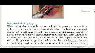 preprosthetic surgical considrations [upl. by Repohtsirhc]