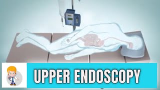 Upper GI endoscopy Esophagogastroduodenoscopy Animation 3D [upl. by Sonnnie]