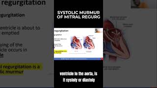 Systolic Murmur of Mitral Regurgitation  MCCQE1 [upl. by Anaibib]