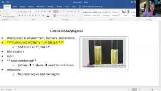 Lysteria monocytogenes tumbling umbrella motility [upl. by Ausoj974]