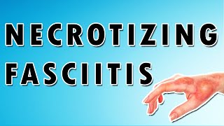 Necrotizing Fasciitis Symptoms Treatment and Causes [upl. by Solrac]