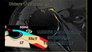 dictare live umar 09 ro [upl. by Root]