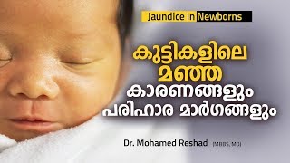 കുഞ്ഞുങ്ങളിലെ മഞ്ഞപിത്തം കാരണങ്ങളും പരിഹാരവും  jaundice in newborn [upl. by Elden]