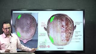 Scalp Anatomy  Explained by DrRajesh Kaushal  Hinglish [upl. by Anuahsat]