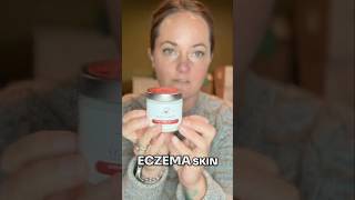 Is This Crème the Solution for Dry Eczema skin [upl. by Airyt]