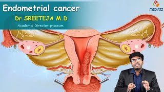 Endometrial Cancer  Obstetrics and gynaecology Video lectures Version 20  Medvizz app [upl. by Aissatsan179]