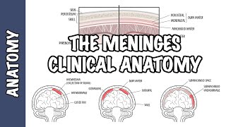 Clinical Anatomy  Meninges Intracranial hematoma subdural epidural subarachnoid and meningitis [upl. by Ahsiemal]