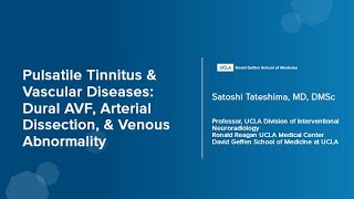 Pulsatile Tinnitus amp Vascular Diseases  Satoshi Tateshima MD DMSc  UCLA Health [upl. by Orella]