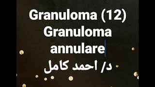 12 Granuloma annulare [upl. by Hogg]