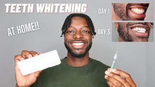 MY TEETH WHITENING ROUTINE AT HOME  OPALESCENCE TEETH WHITENING [upl. by Morissa330]