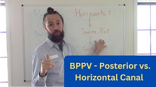 BPPV  Posterior Canal vs Horizontal Canal BPPV [upl. by Ohara]