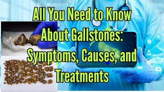 The Complete Guide to Gallstones Symptoms Risks and Treatments gallstones gallstonesymptoms [upl. by Neirual689]