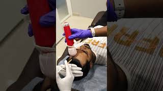 Hair FallGrowth Treatment in Coimbatore coimbatore covai haircare hairlosstreatment [upl. by Gold]