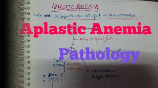 Aplastic anemia Pathology [upl. by Stew580]