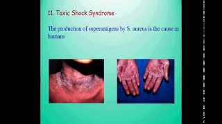 Gram positive cocci StaphylococcusStreptococcusMicrococcus Greasy pig diseasepyoderma of dogs [upl. by Skiba177]