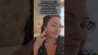 Do you struggle with TMJ pain TMJRelief AcupunctureForTMJ SelfCareRoutine PainFreeLiving [upl. by Georgia]