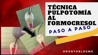 Técnica PULPOTOMÍA AL FORMOCRESOL  paso a paso [upl. by Buford]