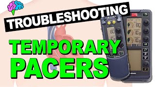 Troubleshooting Pacemaker Problems EXPLAINED [upl. by Ewell857]