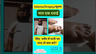 Edema  शरीर में सूजन  Ferrum met 30 homeopathic [upl. by Aglo830]