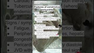 Features of constrictive pericarditis [upl. by Eilrebmik]