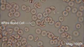 Red blood cells under the microscope hypo and hypertonic solutions [upl. by Ajna172]