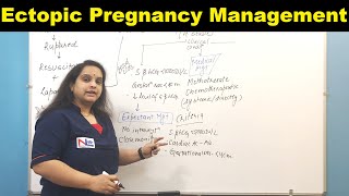 Management of Ectopic Pregnancy  Nursing Lecture [upl. by Odravde774]