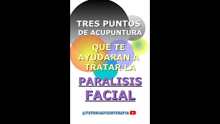 TRATE la PARALISIS FACIAL con estos TRES 3 Maravillosos puntos de acupuntura fisioterapia [upl. by Sirad]