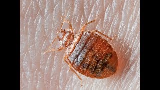 Bedbugs removal only three minutes How to kill bedbug easily മൂട്ടയെ കൊല്ലാംMoota killinog [upl. by Esilrahc]