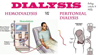 Dialysis  Hemodialysis  Peritoneal dialysis  BIOLOGY ARTICLES AND MCQS [upl. by Rolat]