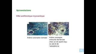 15  Pharmacologie du systeme renine angiotensine aldosterone partie 6 [upl. by Seena150]