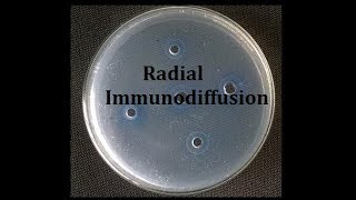 Radial immunodiffusion Teaching kit [upl. by Cadmar]