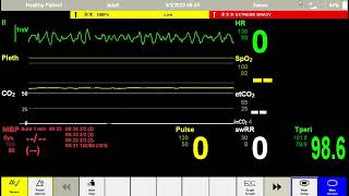 Anesthesia Scenario [upl. by Nadeen364]