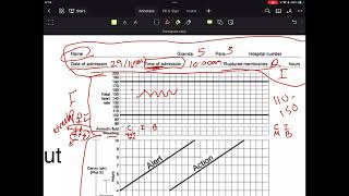 Partogram [upl. by Vipul298]