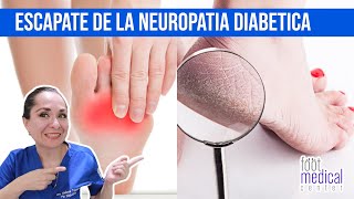 ESCAPATE DE LA NEUROPATIA DIABETICA💥💢 Dra Melissa Tejeida [upl. by Jamill]