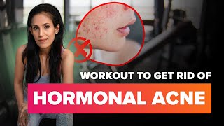 Clear Your Skin with This HormoneBalancing Workout and Exercises to Combat Hormonal Acne [upl. by Benedikt]