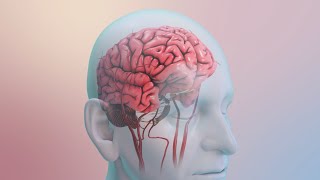 Su riesgo de sufrir un accidente cerebrovascular [upl. by Duhl]