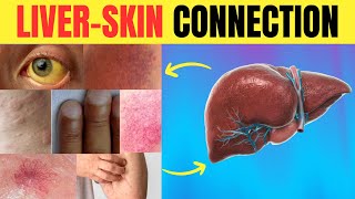 😱 Is Your Skin SCREAMING for Help 🆘 11 LIVER WARNING Signs You Might Miss  Longevity Deprocessed [upl. by Drew]