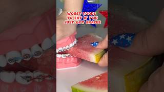 5 FOODS to AVOID if you just got BRACES put ON braces foodasmr satisfying [upl. by Tildie]