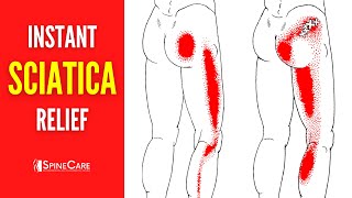 How to Instantly Fix Sciatica Pain [upl. by Tamar862]